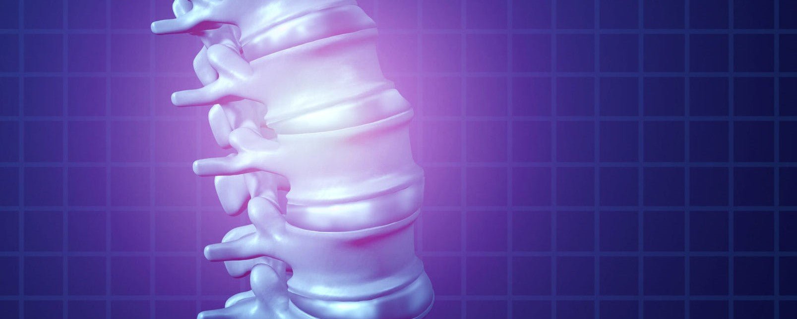 Wetenschappers passen Decompressie toe bij Hernia L4-L5 en doen ...