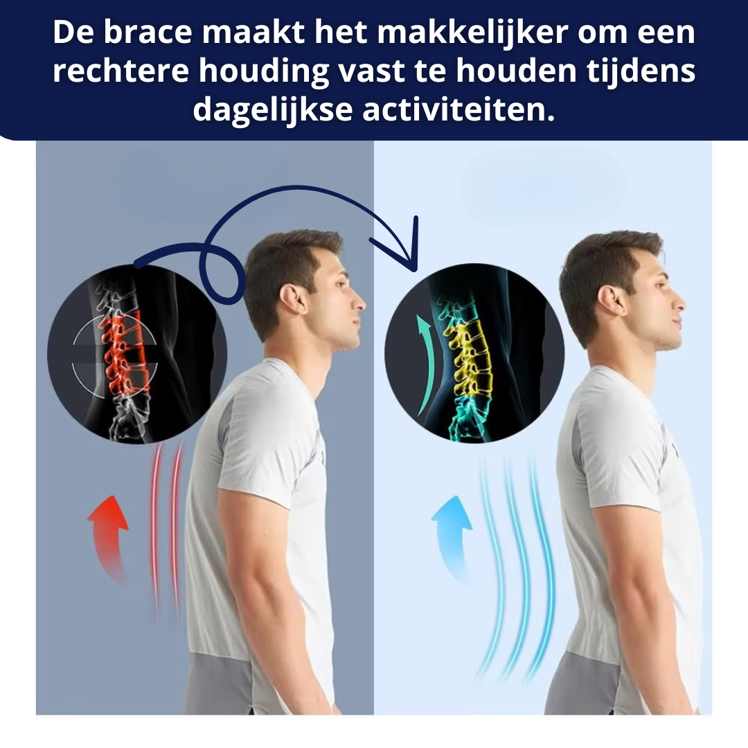 Rugbrace voor Ondersteuning bij de Onderrug – Comfort & Steun bij Scoliose