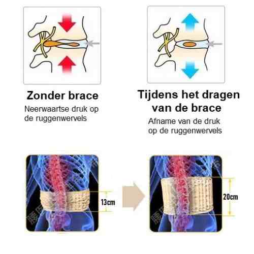 AirSupport - Decompressie Brace - Strek je Rug, Verlicht je Dag
